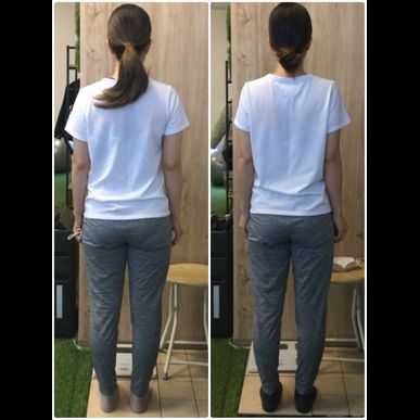 脚が細くなって嬉しいです！ビフォーアフター公開