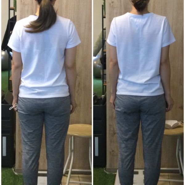 脚が細くなって嬉しいです！ビフォーアフター公開