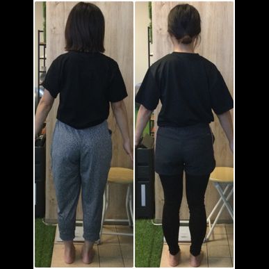 お尻が変われば体型変わる！ビフォーアフターをご覧ください。